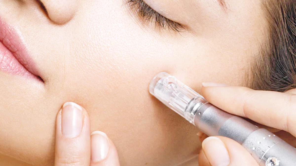 Microneedling - Botox, Fillers, Facials Near Me? Best MedSpa in ...